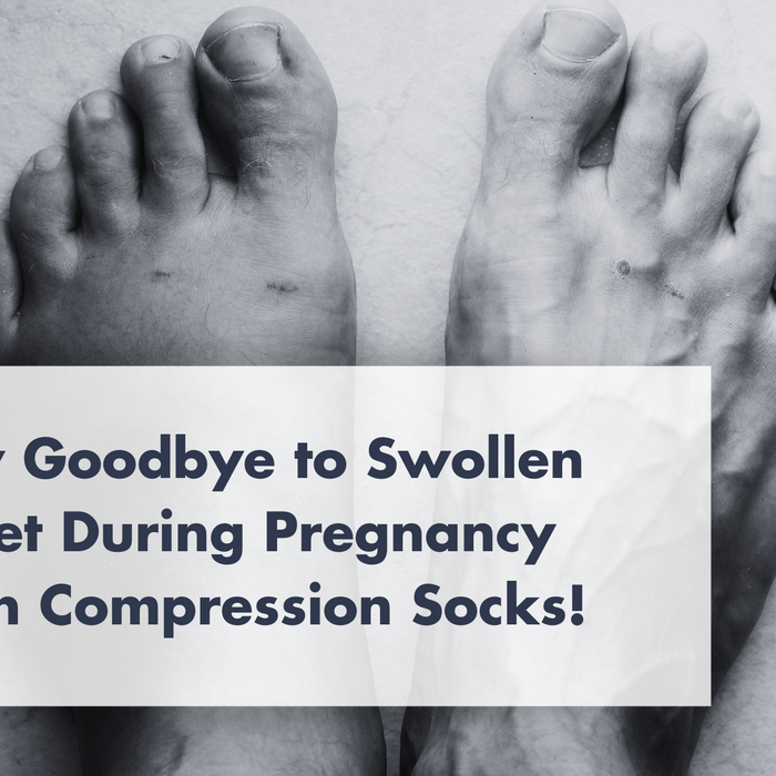 Say Goodbye to Swollen Feet During Pregnancy with Compression Socks!