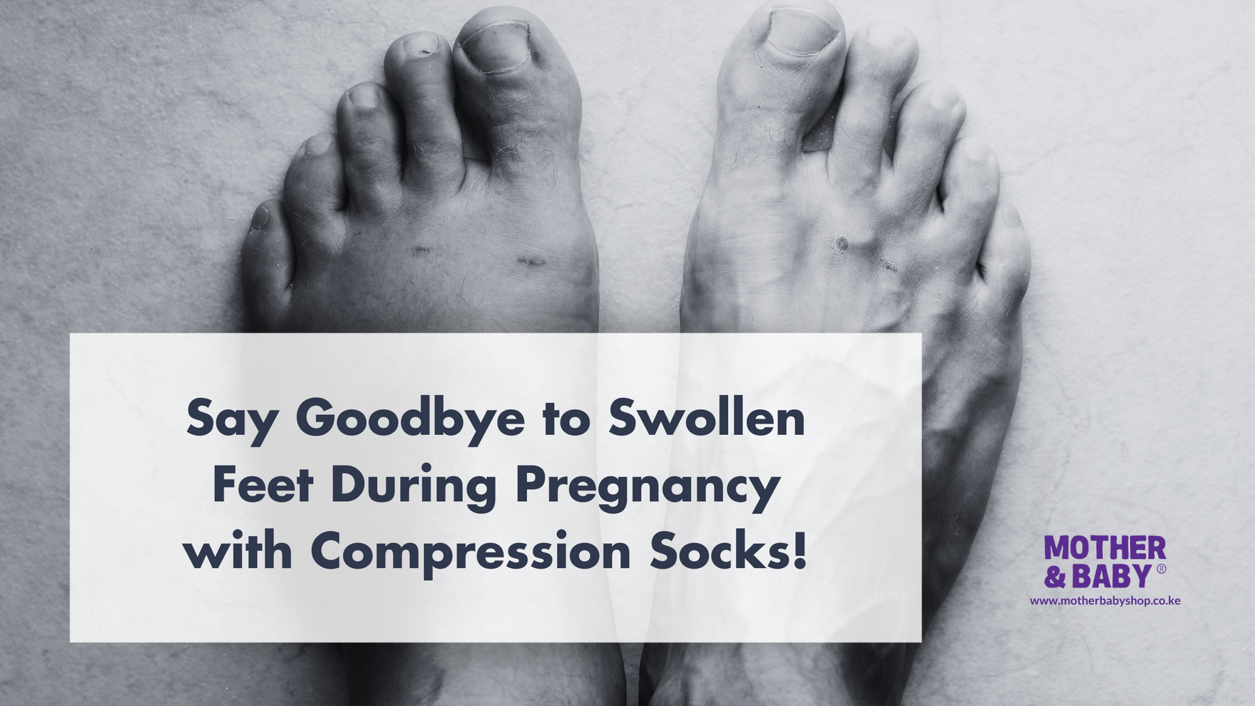 Say Goodbye to Swollen Feet During Pregnancy with Compression Socks!